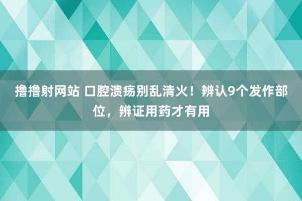 撸撸射网站 口腔溃疡别乱清火！辨认9个发作部位，辨证用药才有用